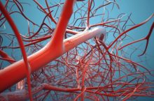 Здоровье сосудов: проблемы, решения, профилактика